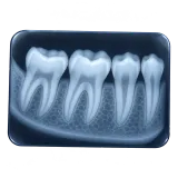 x-ray